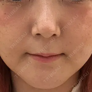 プロクリニック PRO CLINIC プロクリニック 銀座院口コミ