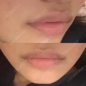 HAAB CLINIC HAAB BEAUTY CLINIC 名古屋院口コミ