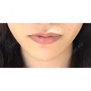 L‘amour clinic Tokyo【ラムールクリニック東京】の