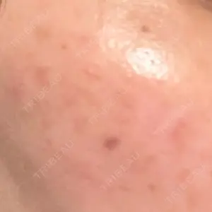 おおかみ美容のクリニック おおかみ美容のクリニック 横浜院口コミ