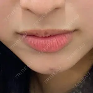 APスキンクリニック銀座口コミ
