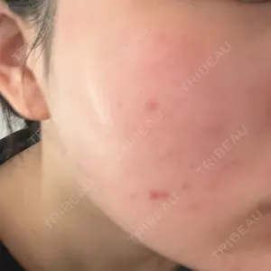 MIO CLINIC 梅田院口コミ