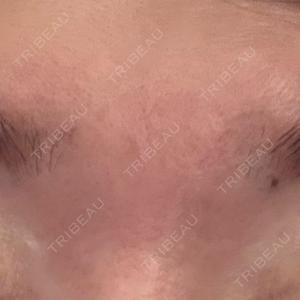 AB美容クリニック AB美容クリニック 新宿院口コミ