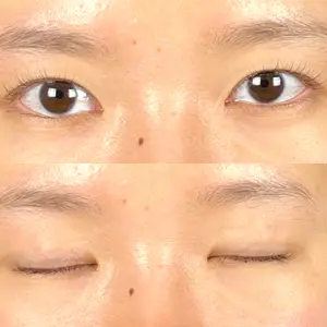 藤・ナチュレ美容クリニック 藤・ナチュレ美容クリニック 銀座院口コミ