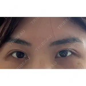 BIANCA CLINIC BIANCA銀座口コミ