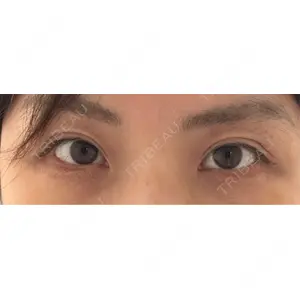 BIANCA CLINIC BIANCA銀座口コミ