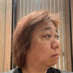 BIANCA CLINIC BIANCA銀座口コミ