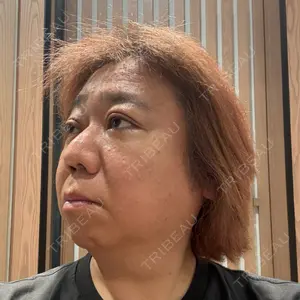 BIANCA CLINIC BIANCA銀座口コミ