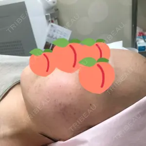 ルラ美容クリニック ルラ美容クリニック銀座院口コミ