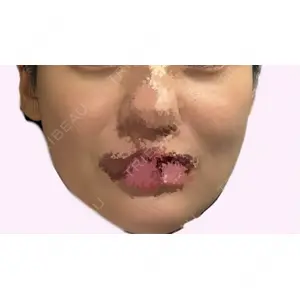 4Dクリニック口コミ