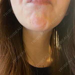 AB美容クリニック AB美容クリニック 新宿院口コミ