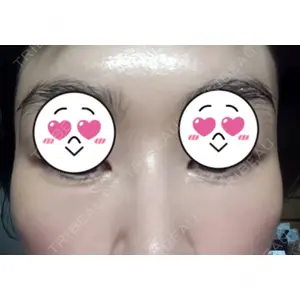 口コミ