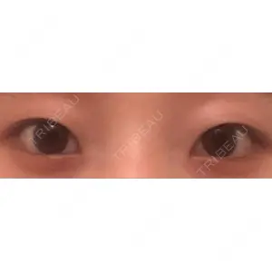 9BeautyClinic口コミ