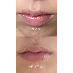 プロクリニック PRO CLINIC プロクリニック 銀座院口コミ