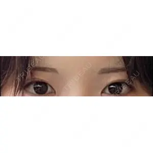 LUHO（ルホ）美容外科口コミ
