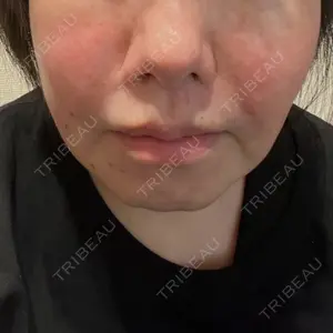 ルラ美容クリニック ルラ美容クリニック 新宿院口コミ