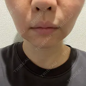 HINATA クリニック口コミ