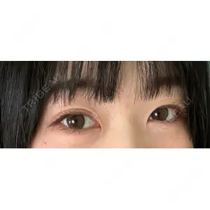 東京シンデレラ美容外科 東京シンデレラ美容外科 池袋院口コミ