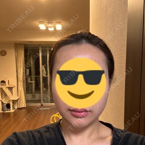 TCB東京中央美容外科 TCB東京中央美容外科 渋谷西口院口コミ