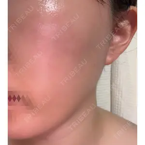 ルラ美容クリニック ルラ美容クリニック 新宿院口コミ