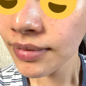 口コミ