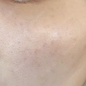 ルラ美容クリニック ルラ美容クリニック 名古屋本院口コミ
