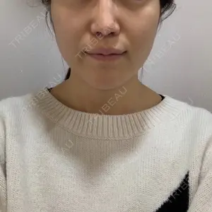 ボンディ美容整形外科（旧リオン整形外科）口コミ