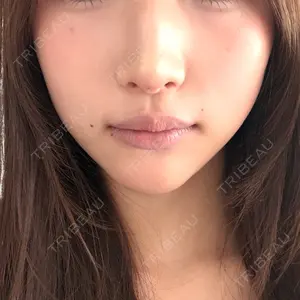 Nebula Clinic 札幌美容外科ネビュラクリニック口コミ