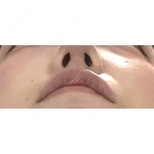 くさのたろうクリニック口コミ