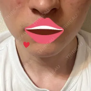 Tokyo Tensei Clinic Tokyo Tensei Clinic 大阪梅田院口コミ