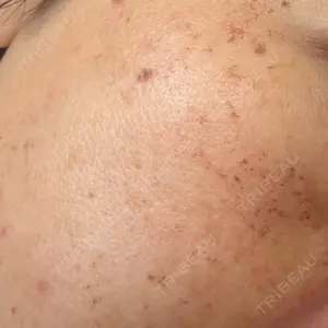 ブルームクリニック（BLOOM CLINIC）口コミ