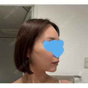 BIANCA CLINIC BIANCA銀座口コミ