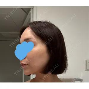 BIANCA CLINIC BIANCA銀座口コミ