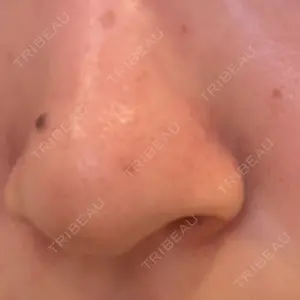 美容皮膚科ティファクリニック 美容皮膚科ティファクリニック 横浜院口コミ