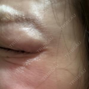 AB美容クリニック AB美容クリニック 新宿院口コミ