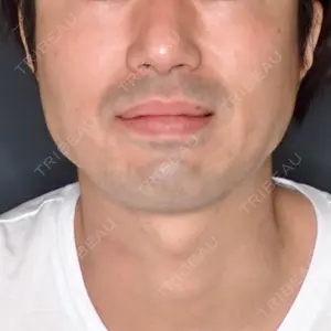 口コミ