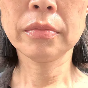医療法人社団 東輝会 Wi Clinic （ウィ クリニック）心斎橋院口コミ
