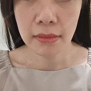 白金ビークリニック 本院口コミ