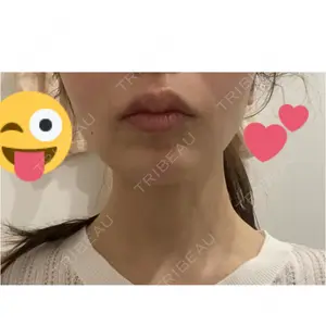 BELINDA CLINIC BELINDA CLINIC（ベリンダクリニック）岡山院口コミ