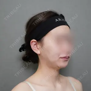 アリエル美容クリニック アリエル美容クリニック 大宮院口コミ