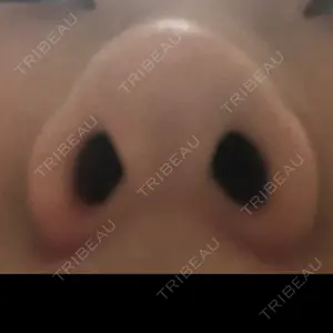 FROM B整形外科 (旧バウム整形外科)口コミ