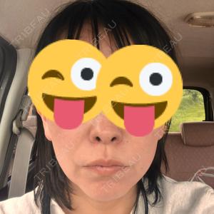 TCB東京中央美容外科 TCB東京中央美容外科 つくば院口コミ