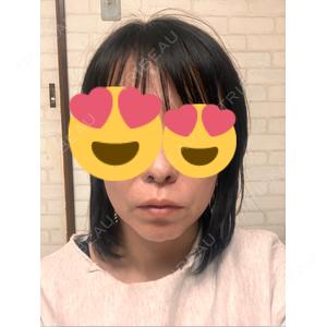TCB東京中央美容外科 TCB東京中央美容外科 つくば院口コミ