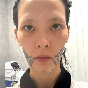EMMO FACE CLINIC EMMO FACE CLINIC 東京三田院口コミ