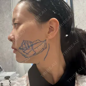 EMMO FACE CLINIC EMMO FACE CLINIC 東京三田院口コミ