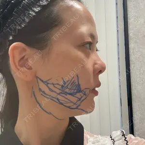 EMMO FACE CLINIC EMMO FACE CLINIC 東京三田院口コミ
