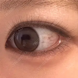 HAAB CLINIC HAAB BEAUTY CLINIC 名古屋院口コミ