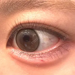 HAAB CLINIC HAAB BEAUTY CLINIC 名古屋院口コミ