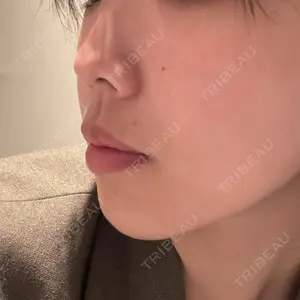 HAAB CLINIC HAAB×DREAM BEAUTY CLINIC 東京本院口コミ