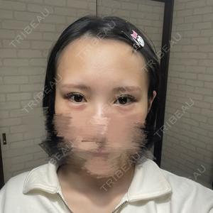TCB東京中央美容外科 TCB東京中央美容外科 つくば院口コミ